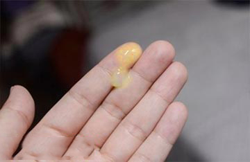 Khi-hu-mau-vang-co-mui-va-cach-giai-quyet