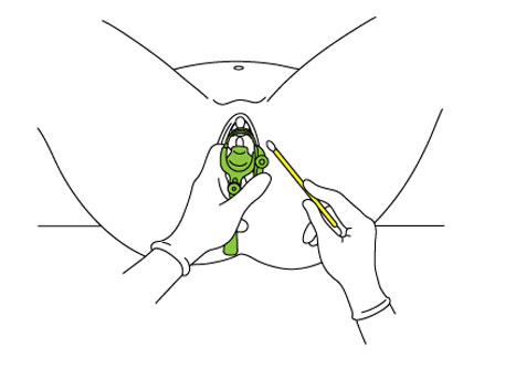 Khi-nao-phu-nu-nen-di-kham-phu-khoa